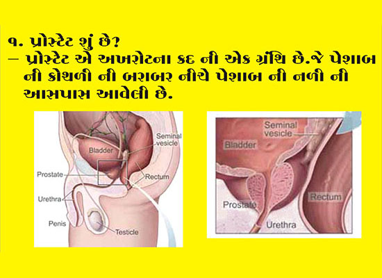 Prostate BPH