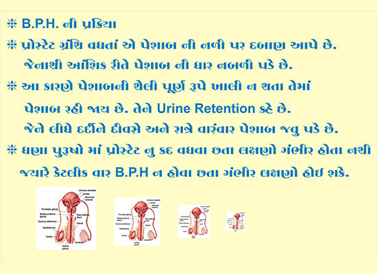 Prostate BPH