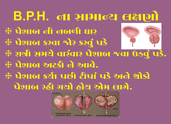 Prostate BPH