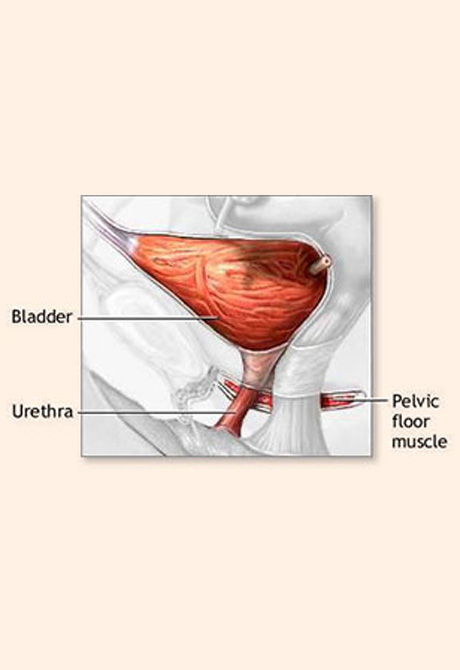 Female Urogyneacology