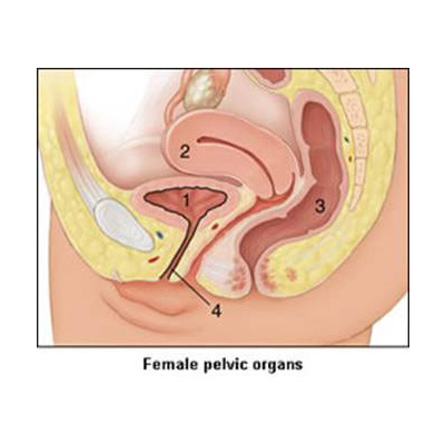 Female Urogyneacology