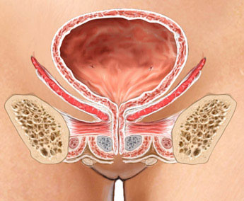 Female Urogyneacology