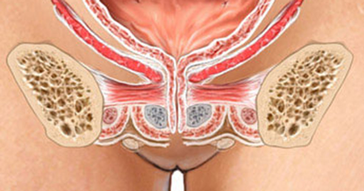 Urogyneacology